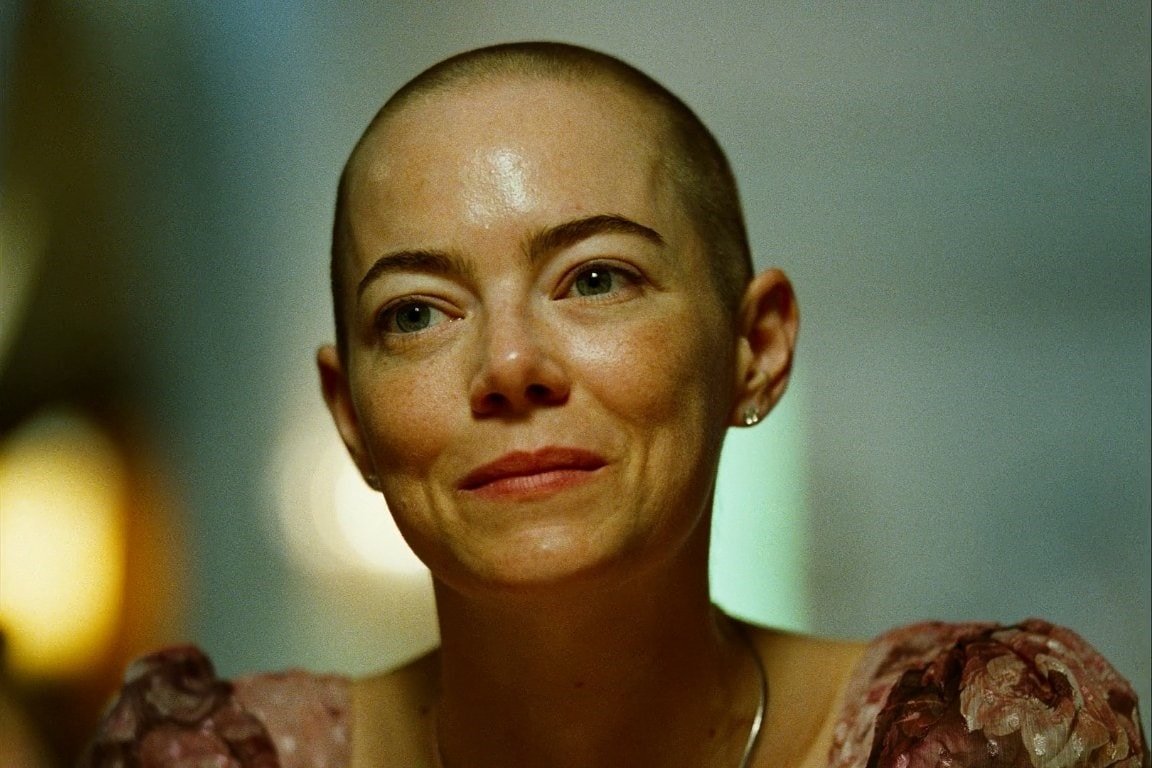 In 2026, women are going bald – Dazed
