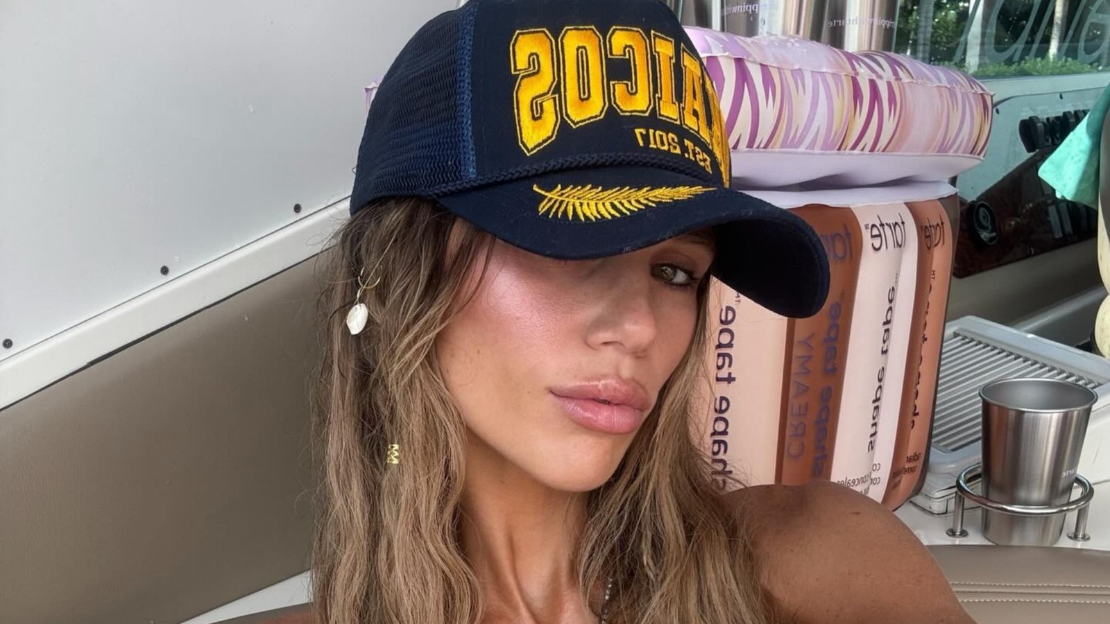After regretting the excessive augmentation of her lips, she encourages people to favor a natural look. – The Body Optimist